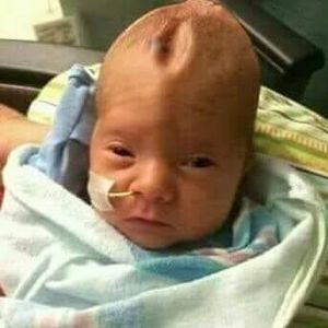 Meet your Posher, Cornelius